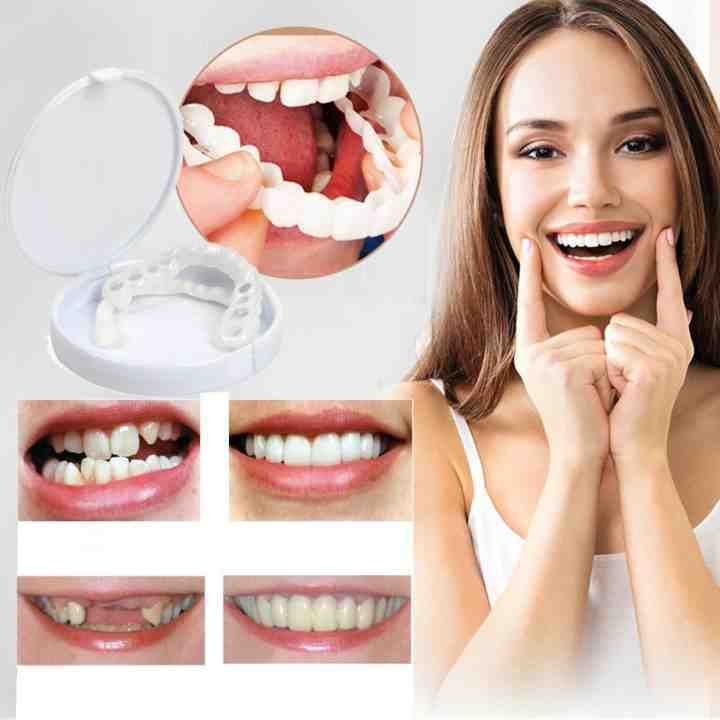 👨‍⚕Adjustable Snap-On Dentures (💥45% OFF) - 🔥HOT SALE🔥🎉